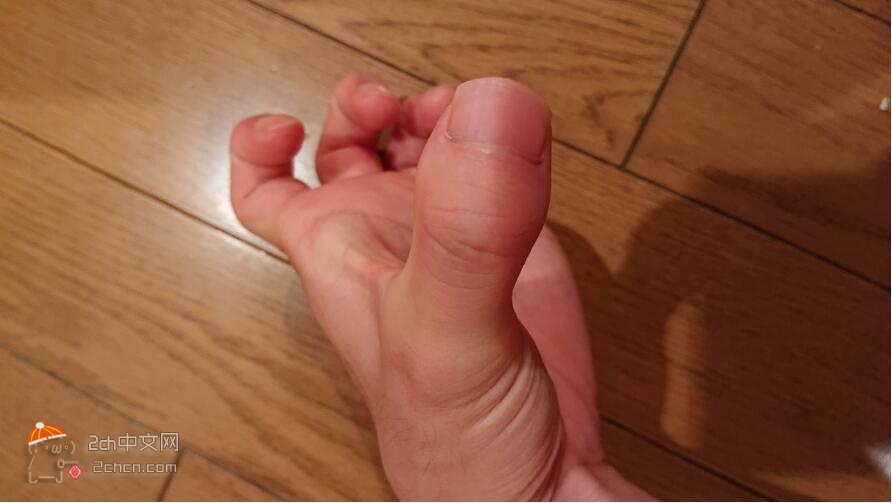 2ch：我被人说大拇指很恶心( ；∀；)