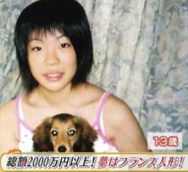 2ch：【悲报】日本妹子整形手术做过头变成了怪物