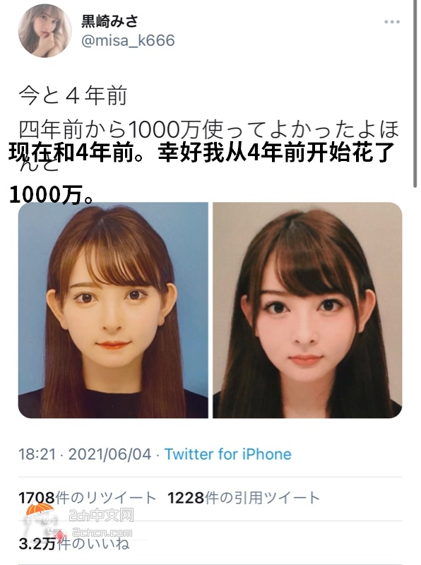 2ch：【悲报】日本妹子「幸好我花1000万整容了」