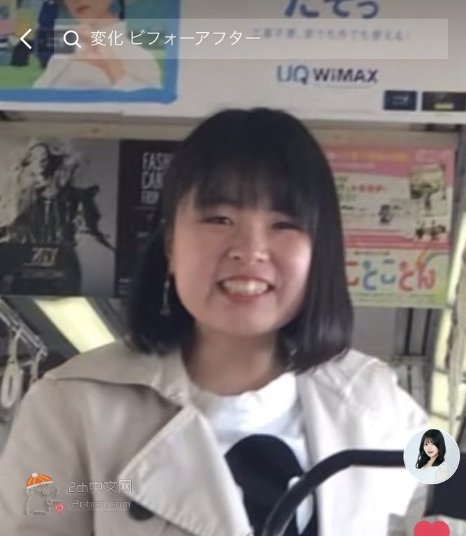 2ch：日本土妹子花4万日元整形，变成了H的女大学生