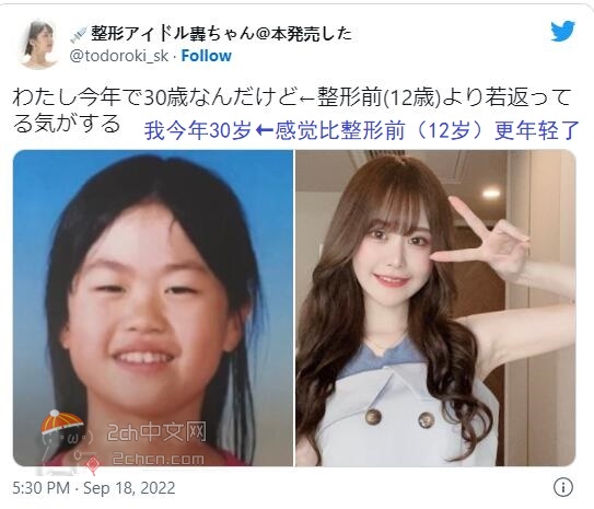 2ch：日本妹子通过整形变成绝世美女wwww