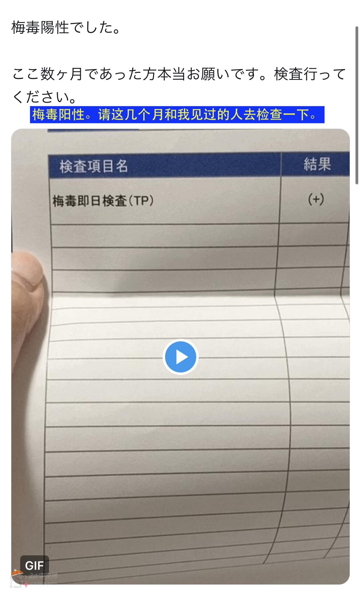 2ch：【悲报】日本爸爸活女子感染梅毒