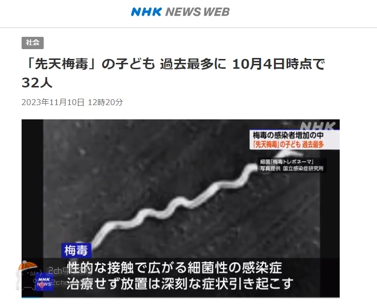 2ch：日本患有先天性梅毒的婴儿达到史上最多wwww