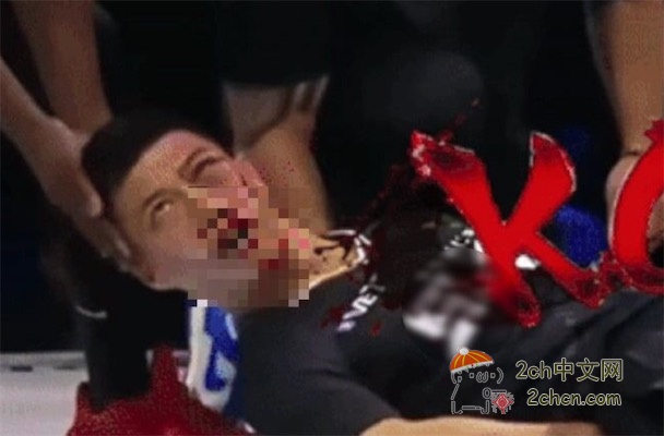 2ch：中国传统武术“通背拳”继承人参加扇耳光大赛，被打到昏迷不醒颧骨骨折