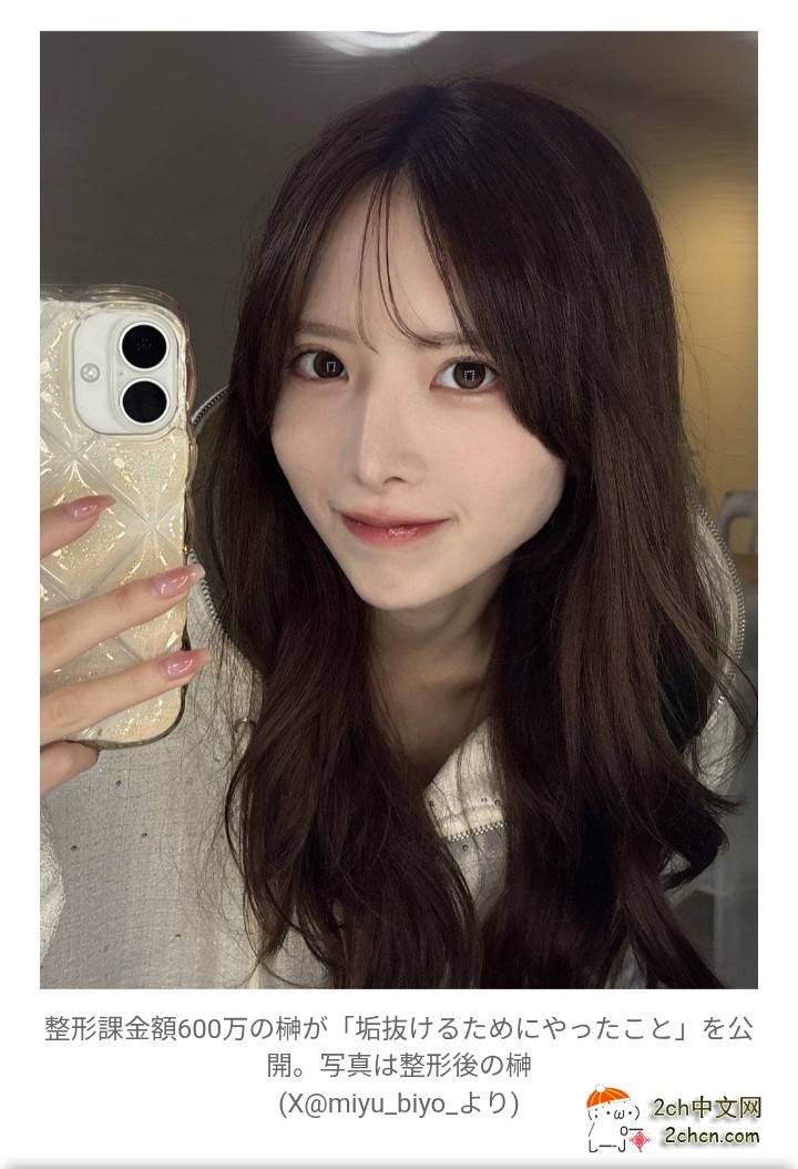 2ch：日本人气偶像花600万日元整形，实现惊艳大蜕变