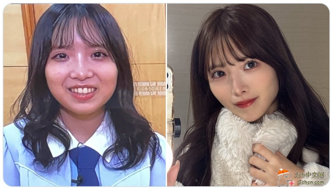 2ch：日本人气偶像花600万日元整形，实现惊艳大蜕变