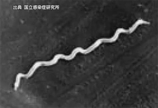 日本爱媛县的梅毒确诊病例创新高，男性确诊者有一半去过风俗店