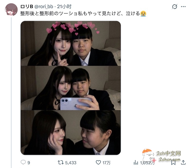 日本女生对比整容前后的合影，看着看着就哭了