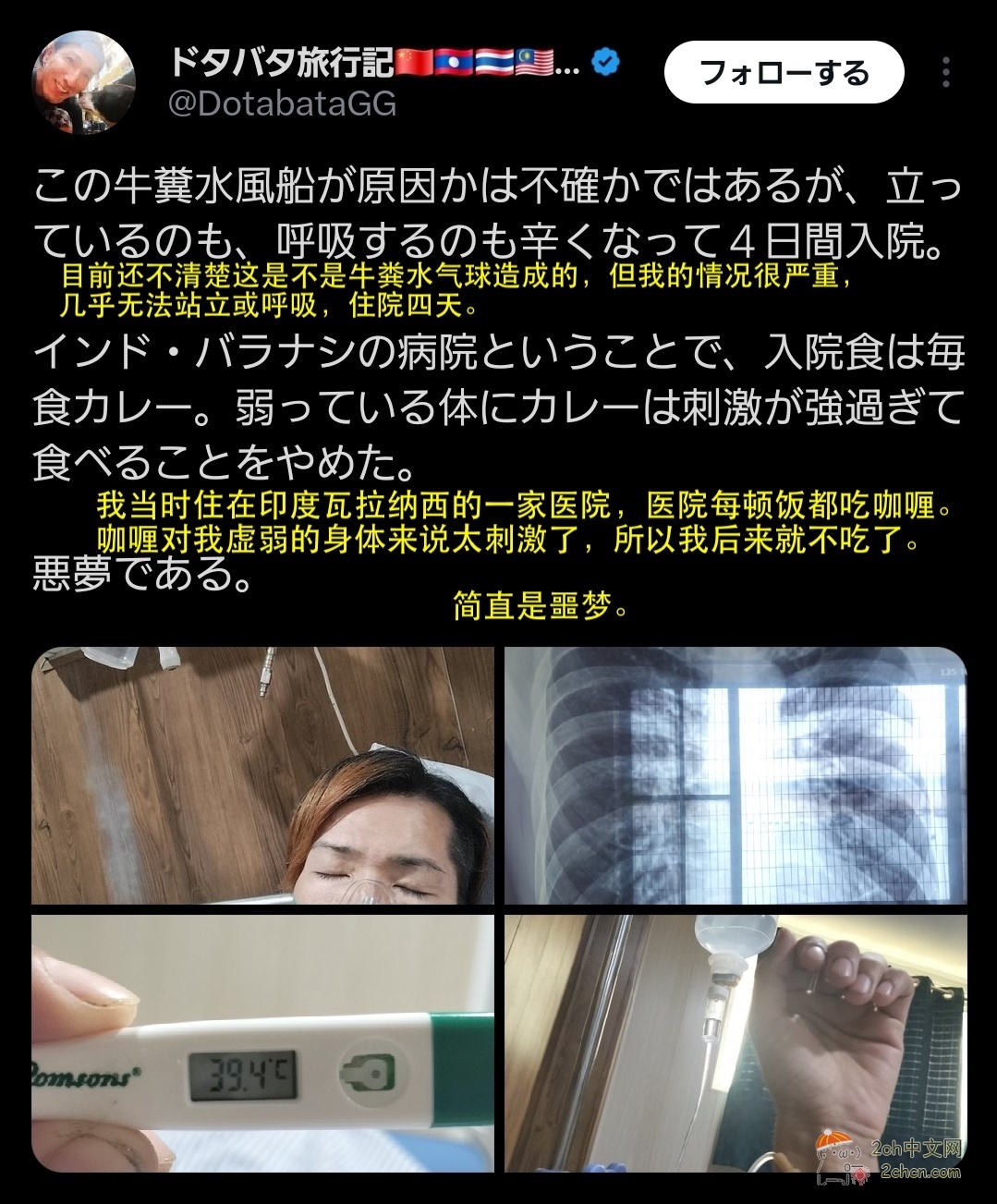 2ch：【悲报】去印度旅行的日本人，被乞讨的印度小孩扔装了牛粪的水气球，两人都高烧住院