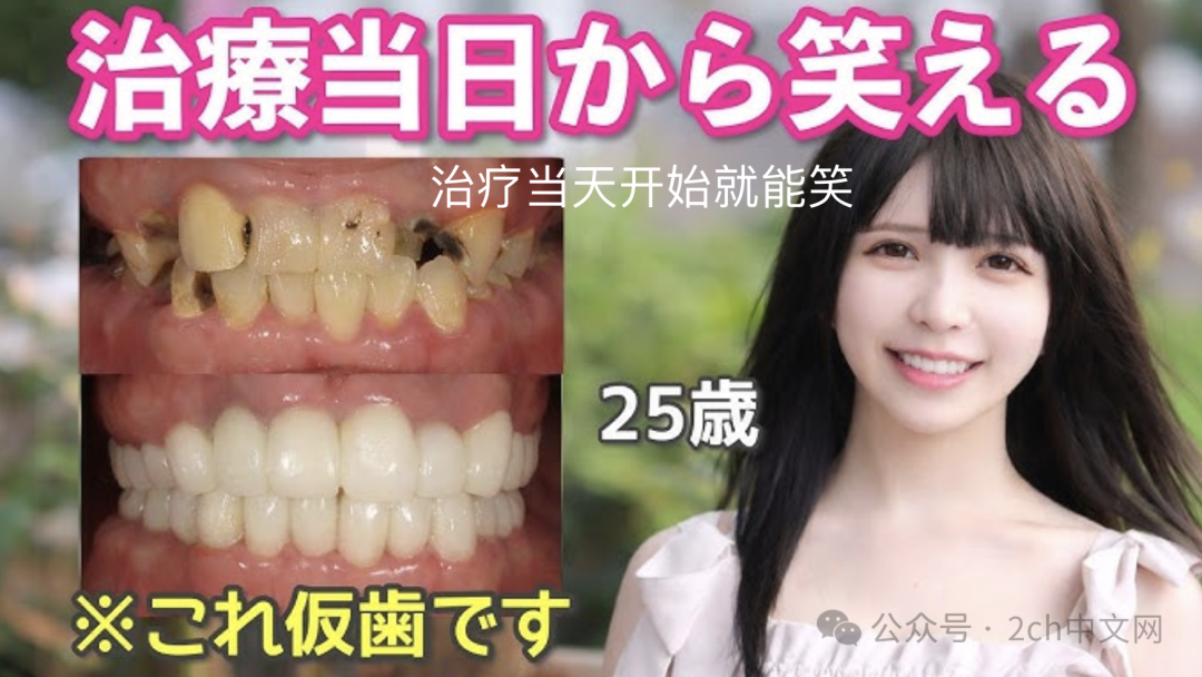 2ch：因牙齿残缺不齐而失去笑容的日本JK，在牙医那里换上纯白的牙齿后重新找回了笑容
