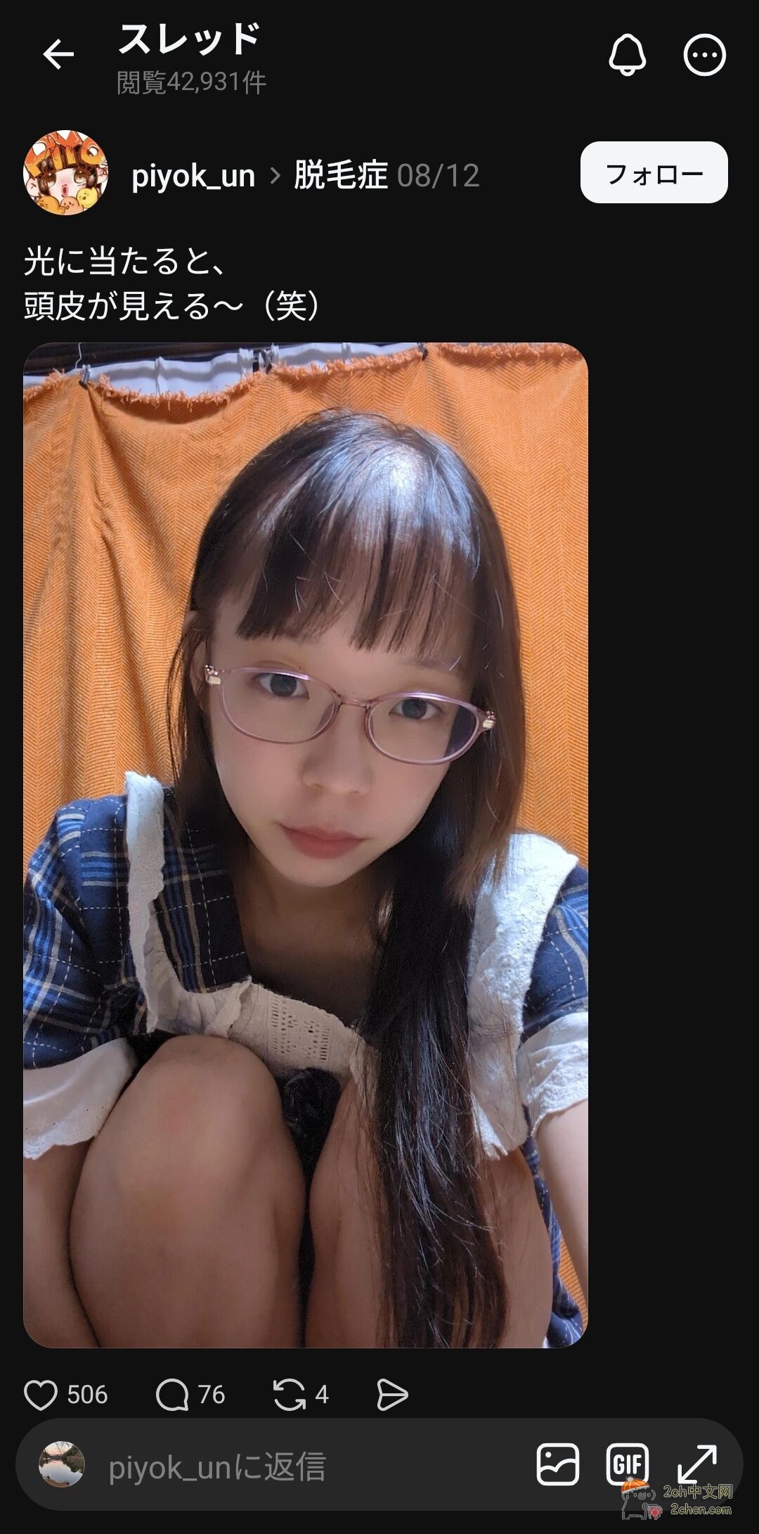 2ch：发现了一个患有“脱发症”的美少女
