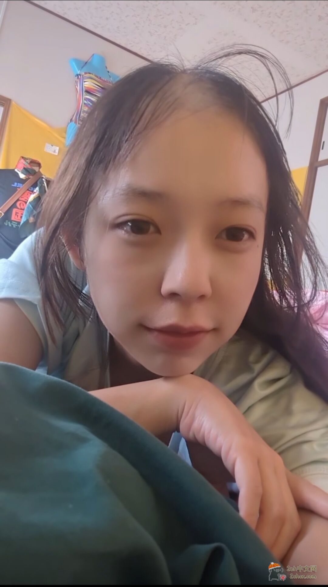 2ch：发现了一个患有“脱发症”的美少女