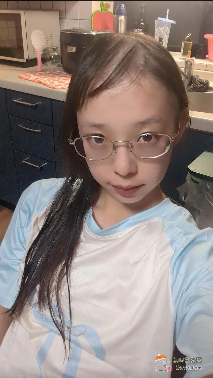 2ch：发现了一个患有“脱发症”的美少女
